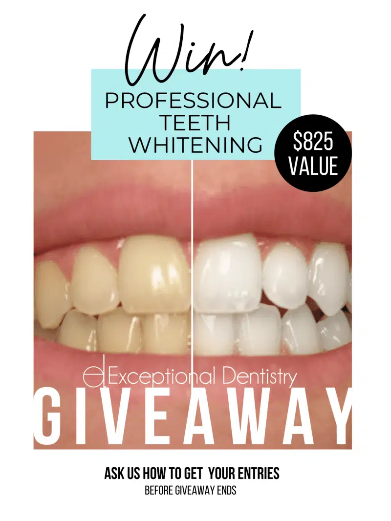 Professional home teeth whitening complete review giveaway
